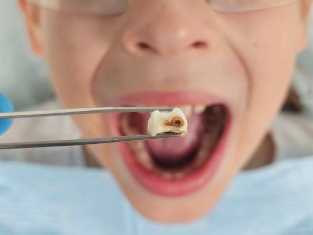 Best Broken or Cracked Tooth Emergency Dentist in Oliver Springs, TN